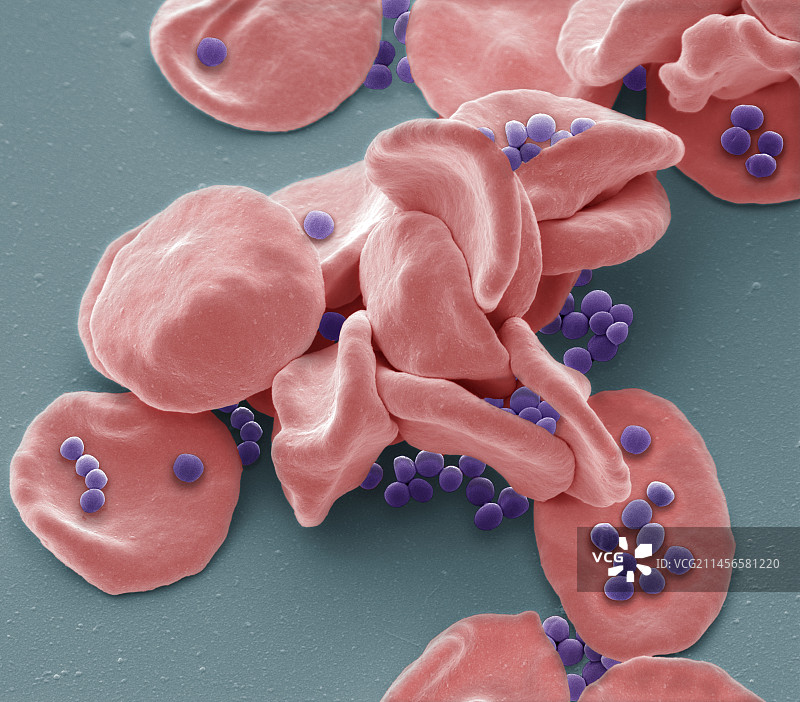 A组链球菌感染，扫描电镜图片素材