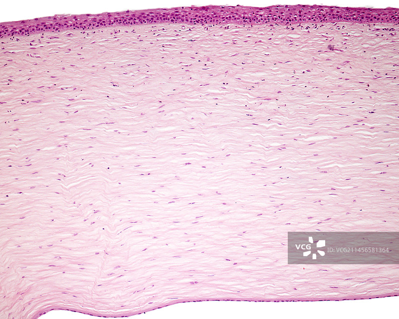 人眼角膜显微照片图片素材