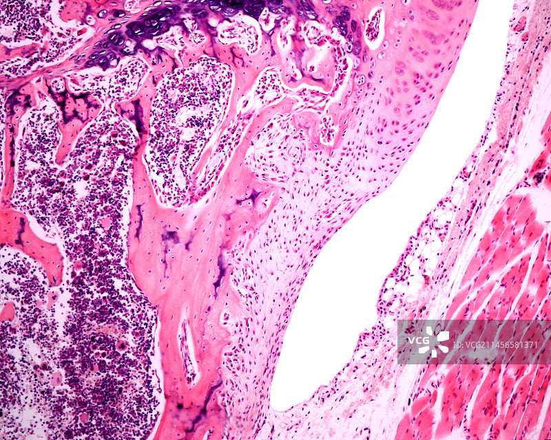 关节滑膜显微照片图片素材
