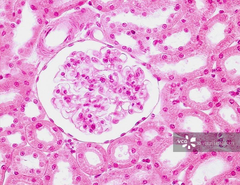 肾小球显微照片图片素材