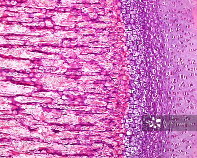 骨骼发育显微照片图片素材