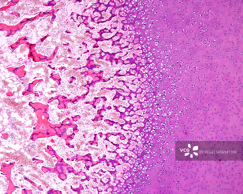 骨骼发育显微照片图片素材