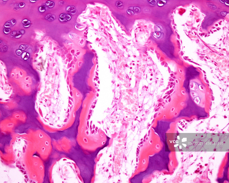 软骨内骨化，光学显微照片图片素材