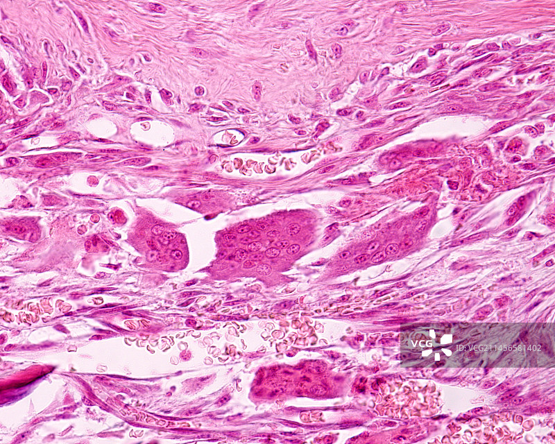 破骨细胞显微照片图片素材
