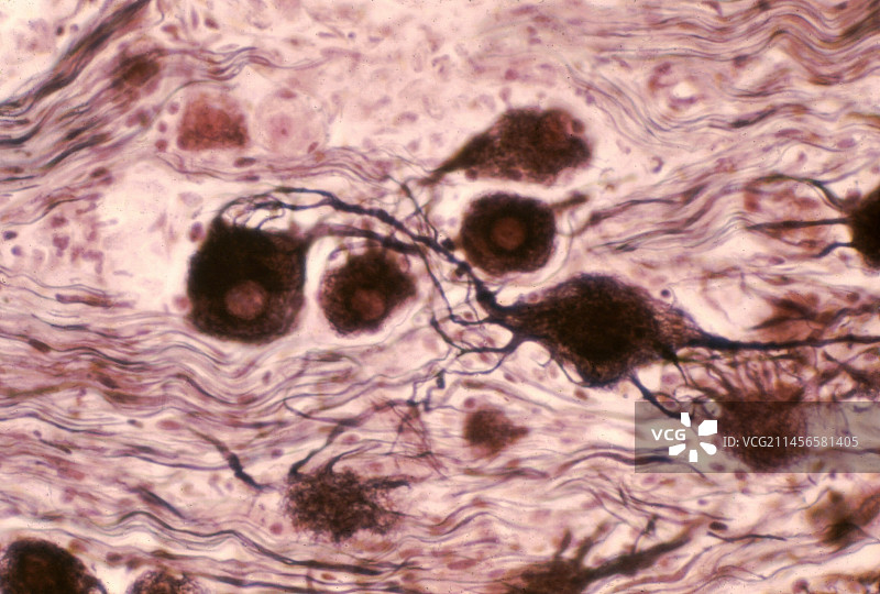 自主神经节神经元显微照片图片素材