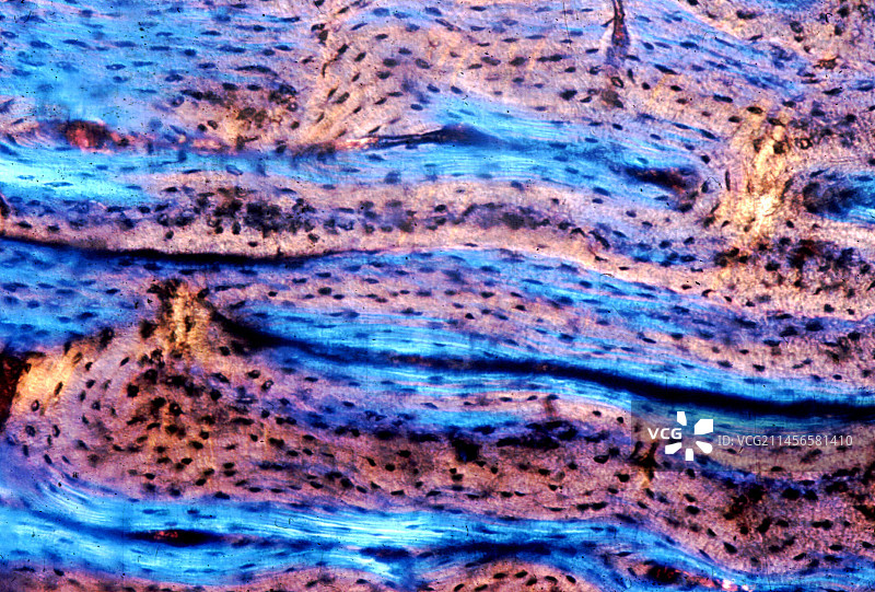 骨骼结构显微照片图片素材