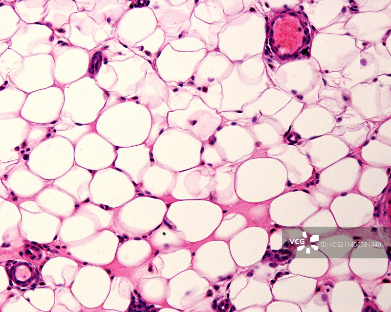 脂肪组织，光学显微照片图片素材