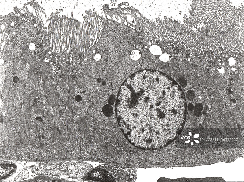 肾脏近端小管，TEM图片素材