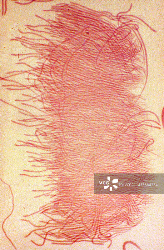 蚱蜢精子显微照片图片素材