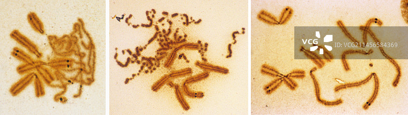 早发性染色体浓缩，光学显微照片图片素材