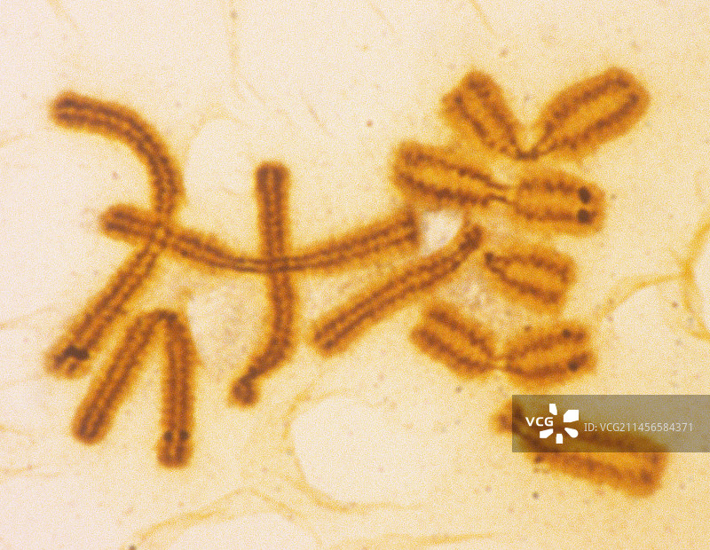 冷凝染色体显微照片图片素材