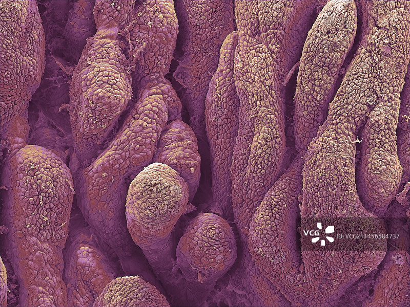 子宫扫描电镜图图片素材