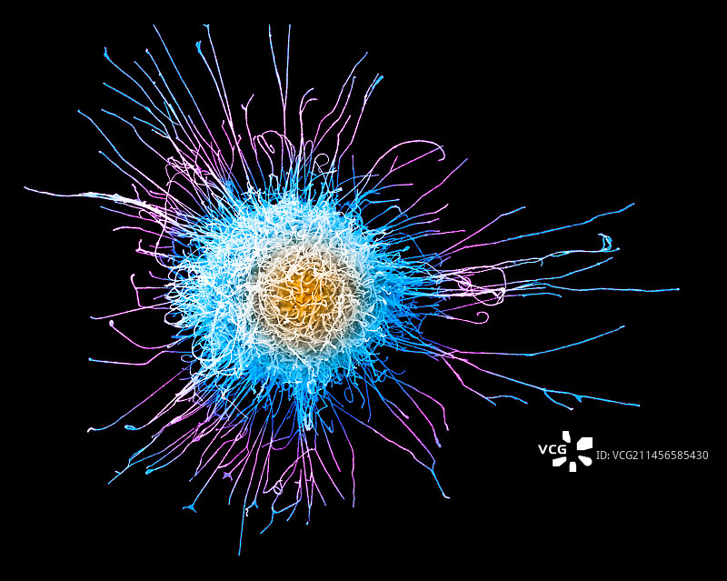 宫颈癌细胞扫描电镜图图片素材