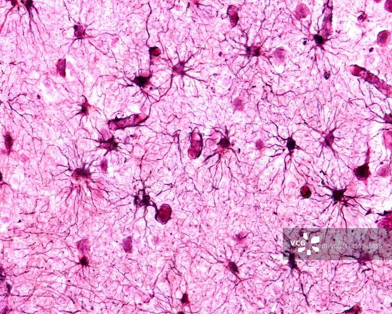 原生质星形胶质细胞显微照片图片素材