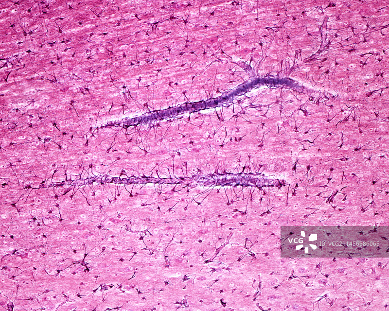 纤维星形胶质细胞显微照片图片素材