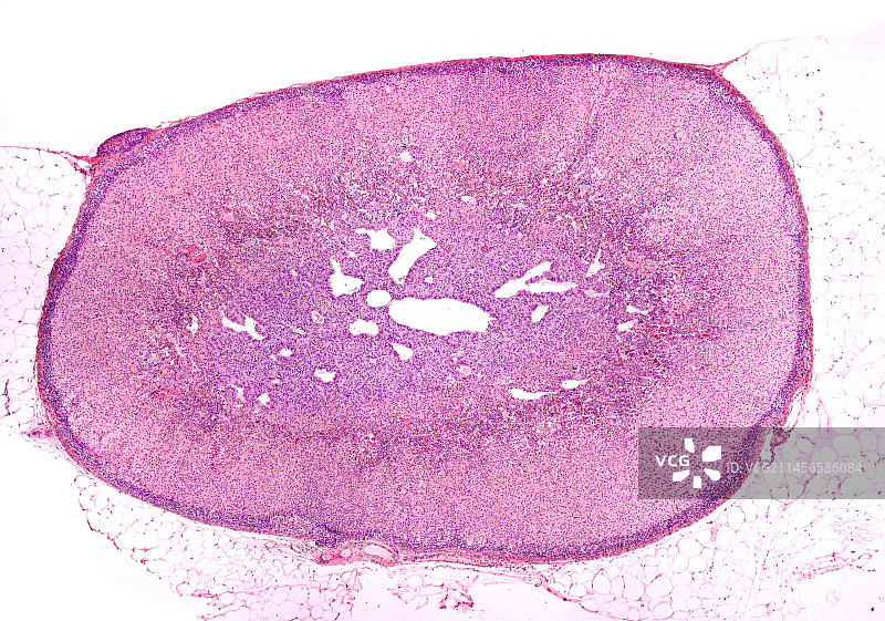 肾上腺光学显微照片图片素材