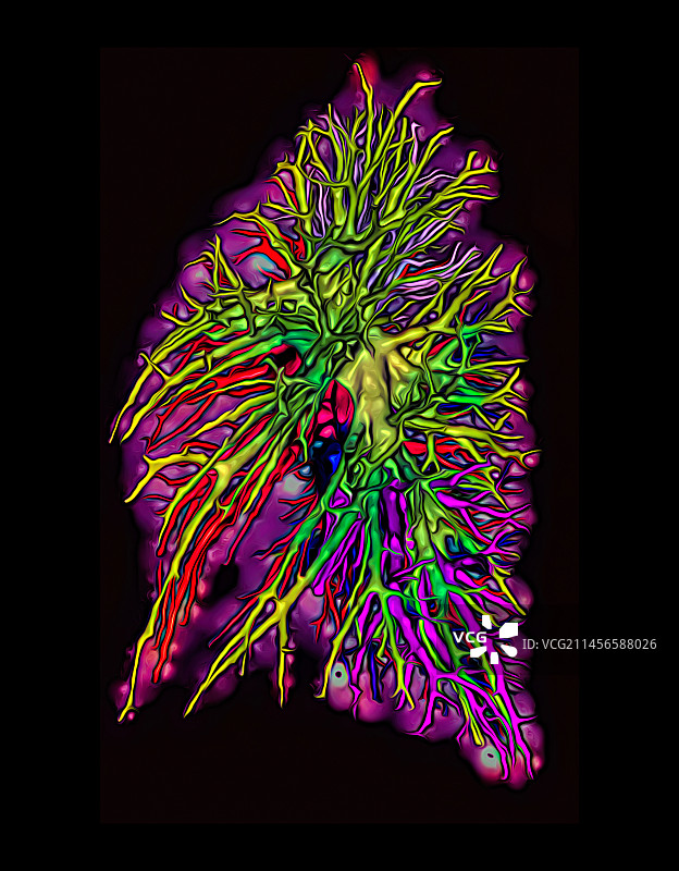 健康的肺部CT扫描图片素材