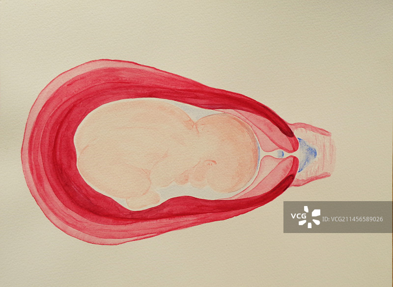 子宫颈变薄和扩张插图图片素材