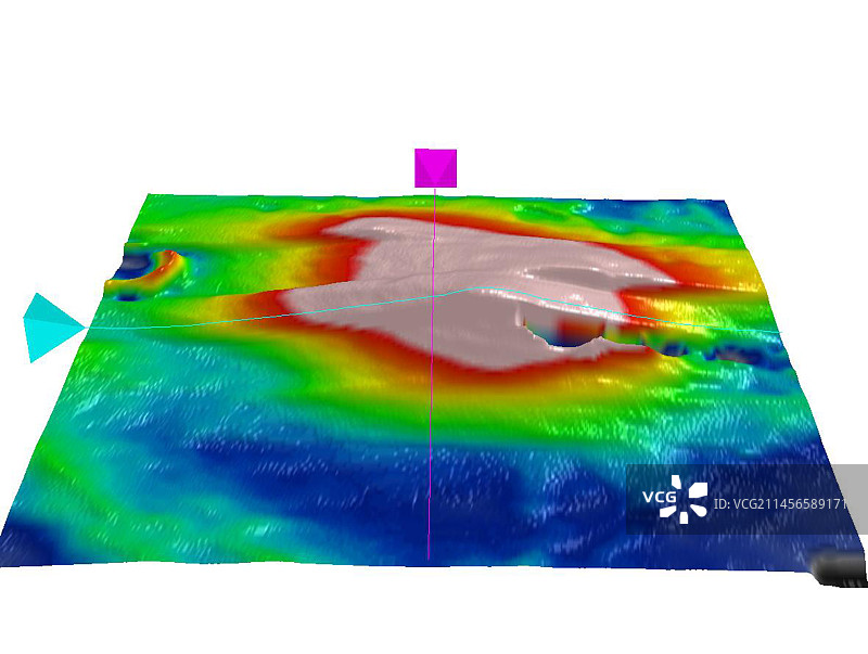 糖尿病性黄斑水肿OCT扫描图片素材