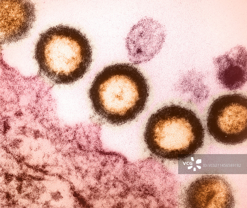 细胞中艾滋病毒颗粒,透射电子显微镜图片素材