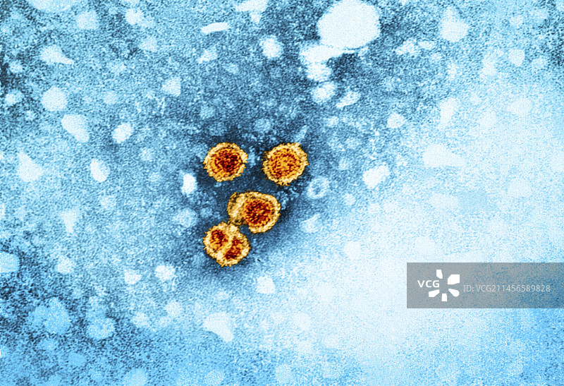 乙型肝炎病毒颗粒（透射电镜）图片素材