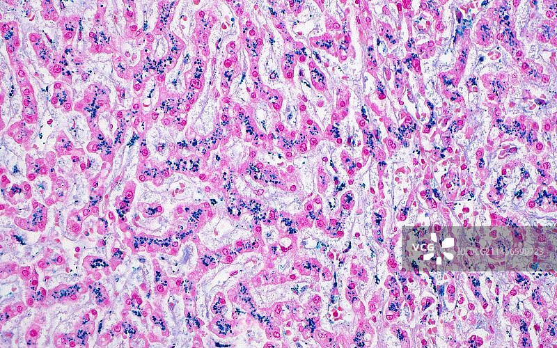 肝细胞中的铁，显微照片图片素材