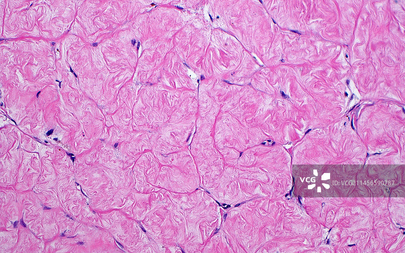 卵巢白体，光学显微照片图片素材