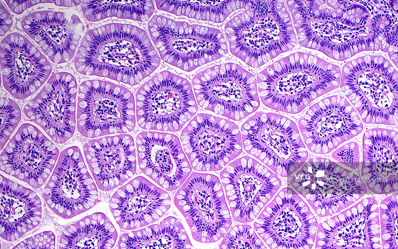 小肠显微照片图片素材