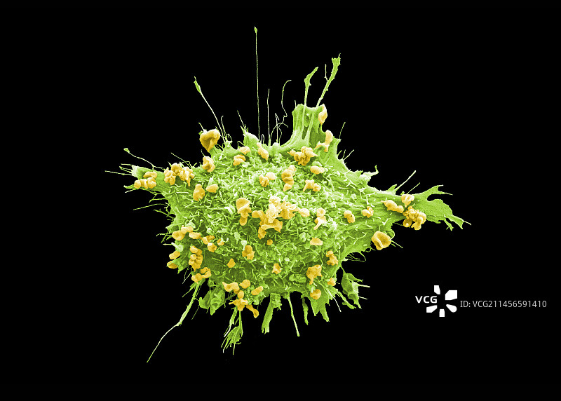 宫颈癌细胞扫描电镜图图片素材