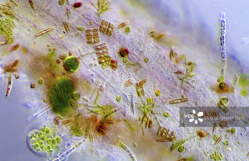 定居在浮萍根部的微藻显微照片图片素材