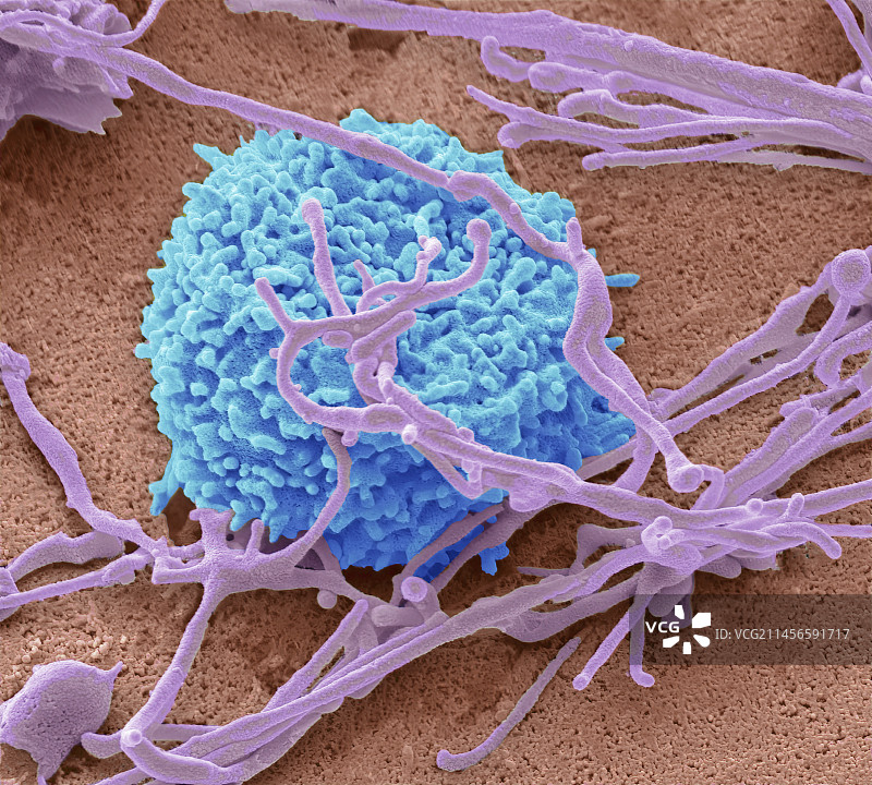自然杀伤细胞，扫描电子显微镜图片素材