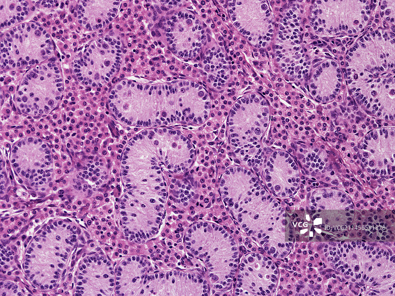 胎儿睾丸显微照片图片素材