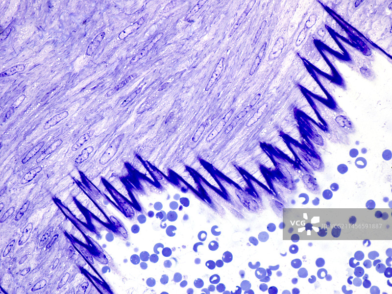 动脉壁显微照片图片素材
