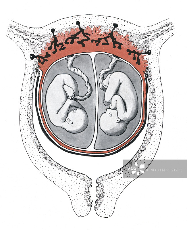 双胞胎胎儿插图图片素材