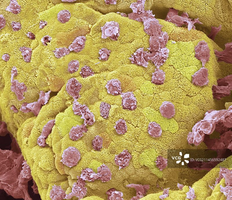 结肠扫描电镜图图片素材