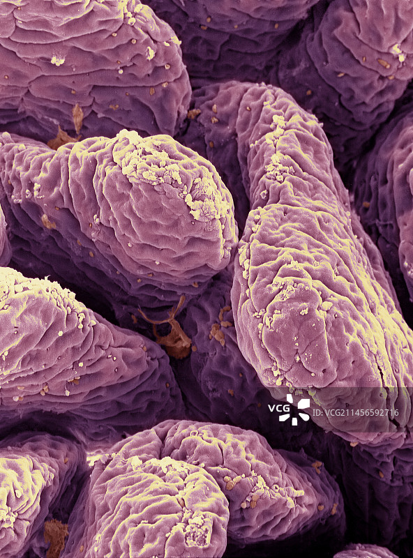 小肠扫描电镜图图片素材