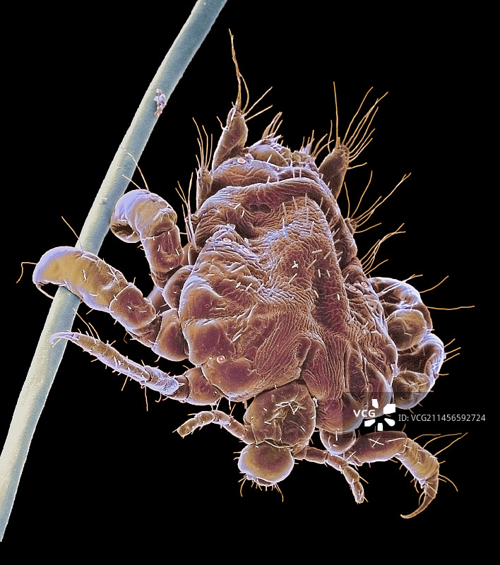 阴虱（扫描电镜）图片素材