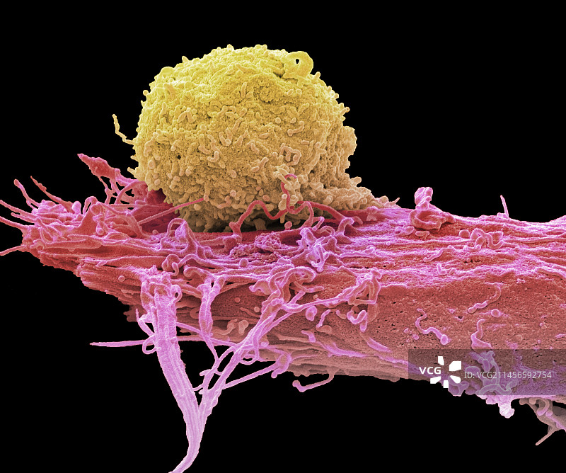 CAR T细胞疗法，扫描电镜图片素材