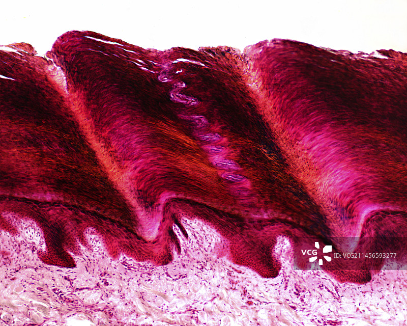 顶泌汗腺显微照片图片素材