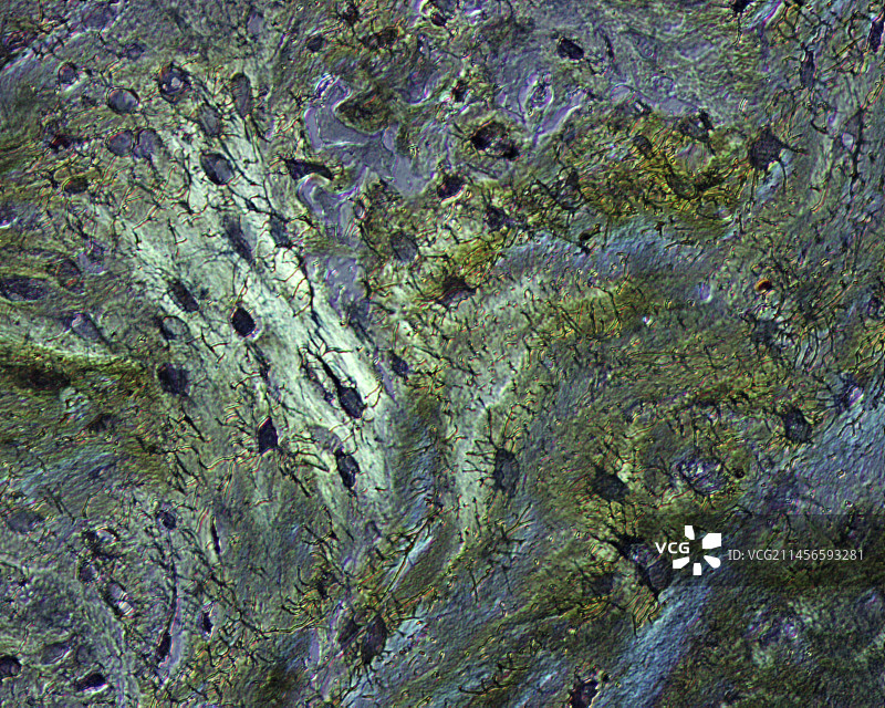 骨骼结构显微照片图片素材