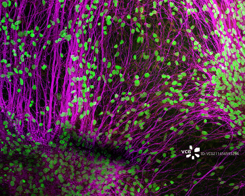 干细胞衍生的神经元，光学显微照片图片素材
