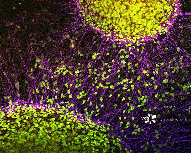 干细胞衍生的神经元，光学显微照片图片素材