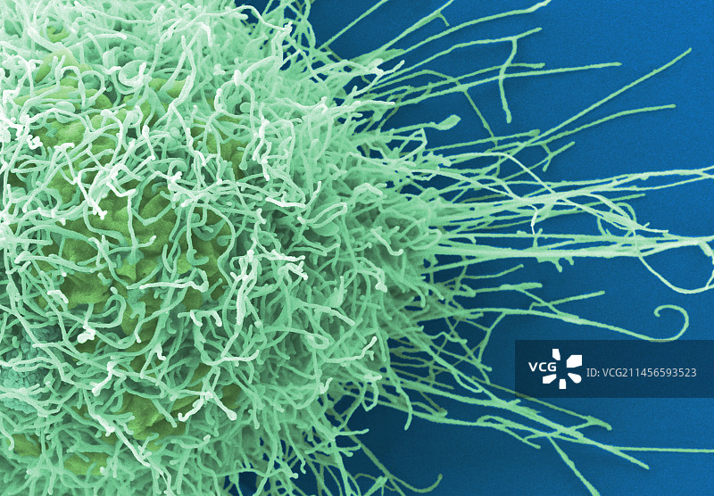 宫颈癌细胞扫描电镜图图片素材