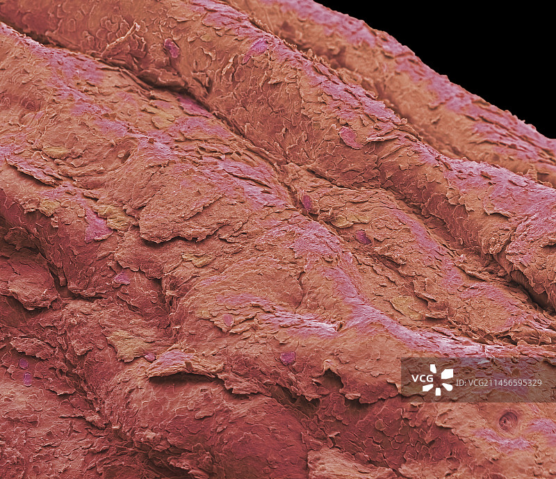 手指皮肤扫描电子显微镜图图片素材