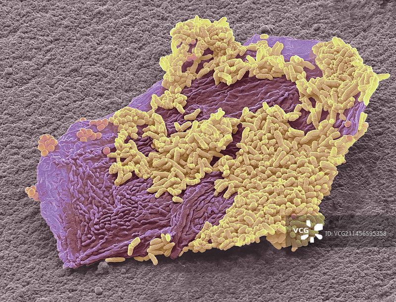 脚癣真菌，扫描电子显微镜图片素材