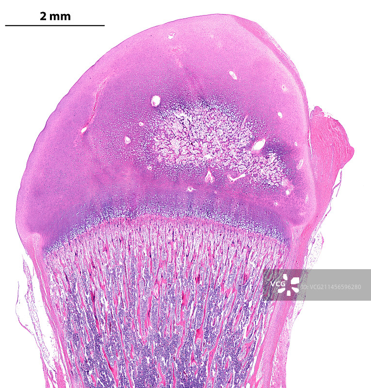 发育中的长骨，光学显微照片图片素材