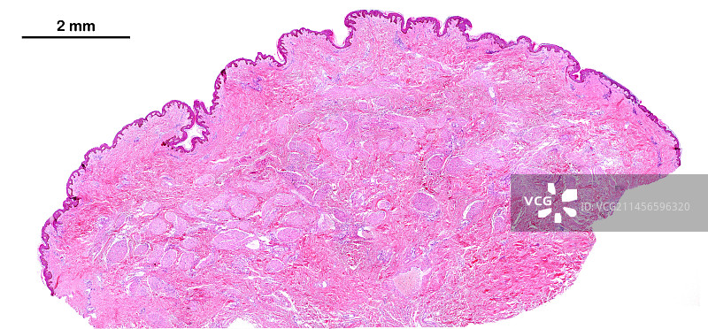 人的乳头，光学显微照片图片素材