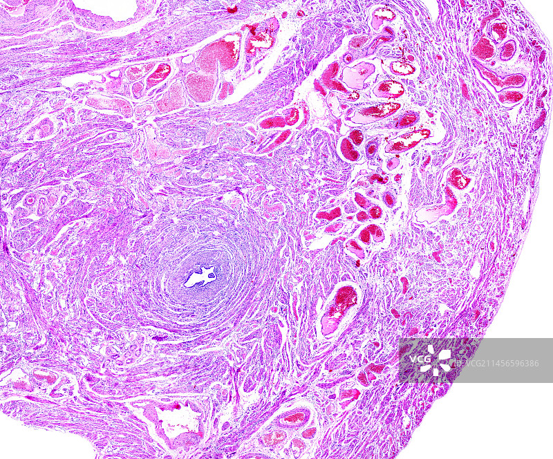 人输卵管显微照片图片素材
