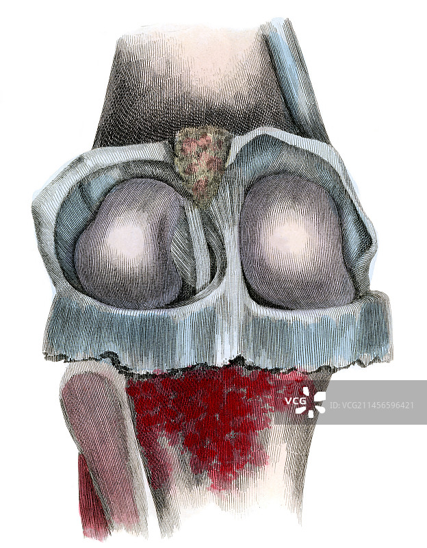 膝关节图示图片素材