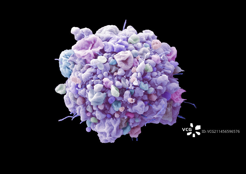 宫颈癌细胞凋亡，扫描电镜图片素材